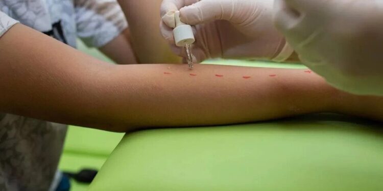 АСІТ-терапія: коли слід переходити від симптомів до причини