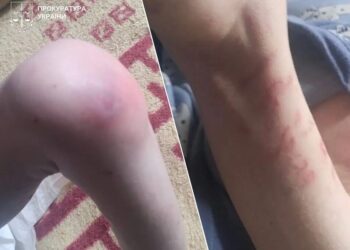 Таргани, недоїдання та синці: під Києвом троє дітей жили без належного догляду, прокуратура відкрила провадження