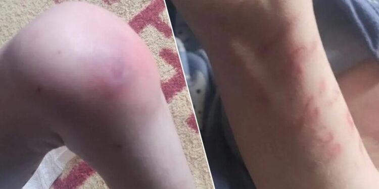 Таргани, недоїдання та синці: під Києвом троє дітей жили без належного догляду, прокуратура відкрила провадження