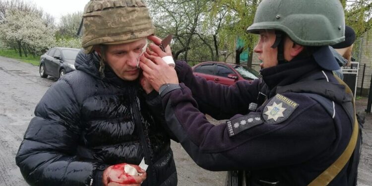 На Дніпровщині чоловік підірвав гранату під час затримання, поранено 5 поліцейських