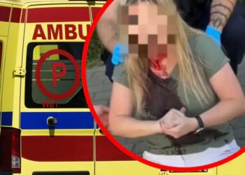 У польській Ґдині невідомий вдарив українку тростиною по голові, нападника розшукує поліція – ЗМІ