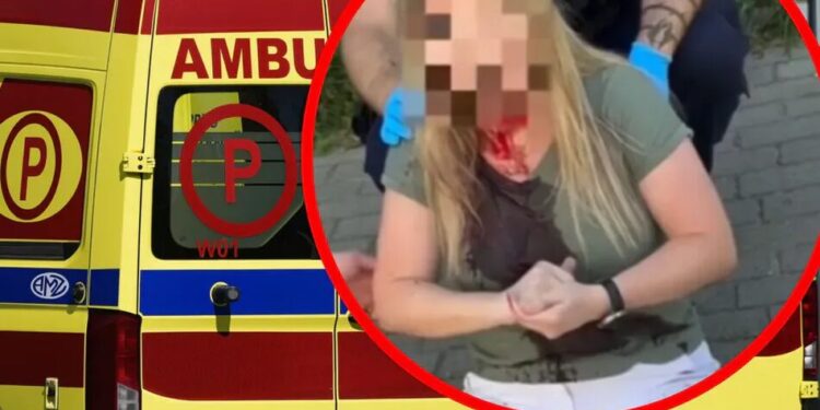 У польській Ґдині невідомий вдарив українку тростиною по голові, нападника розшукує поліція – ЗМІ