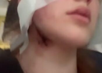 У мережі повідомили про напад на українських дівчину і хлопця у Вроцлаві через акцент
