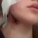 У мережі повідомили про напад на українських дівчину і хлопця у Вроцлаві через акцент