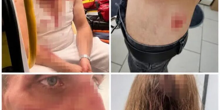 Консульство відреагувало на новий напад на українців у Польщі: на зв'язку з постраждалими та польськими органами