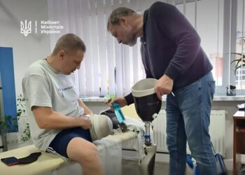Протезування за держпрограмою: Кабмін змінює умови для складних випадків