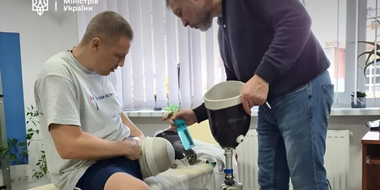 Протезування за держпрограмою: Кабмін змінює умови для складних випадків